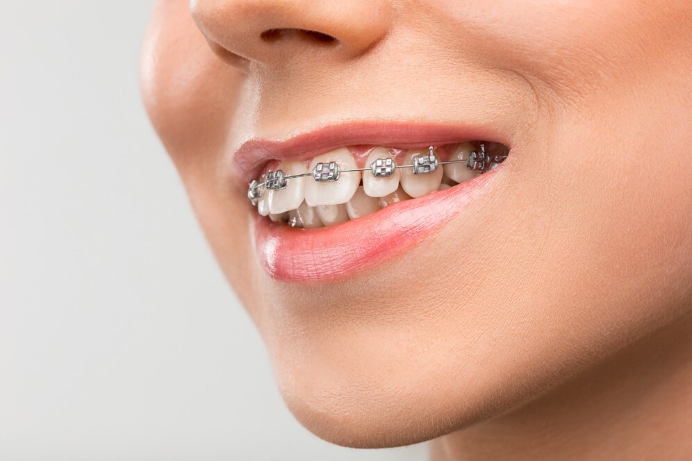 Wizyty u ortodonty w starszym wieku? Czemu nie!